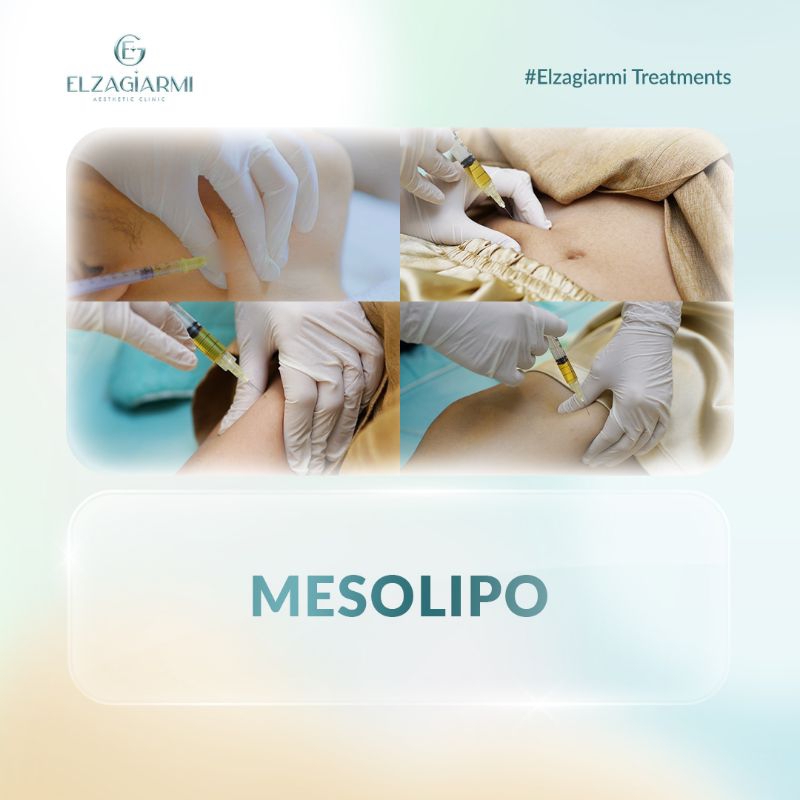 Premium Mesolipo Treatment