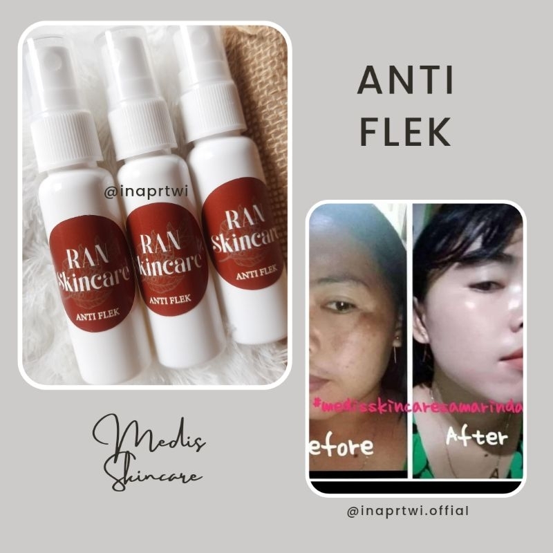 ANTI FLEK medis skincare