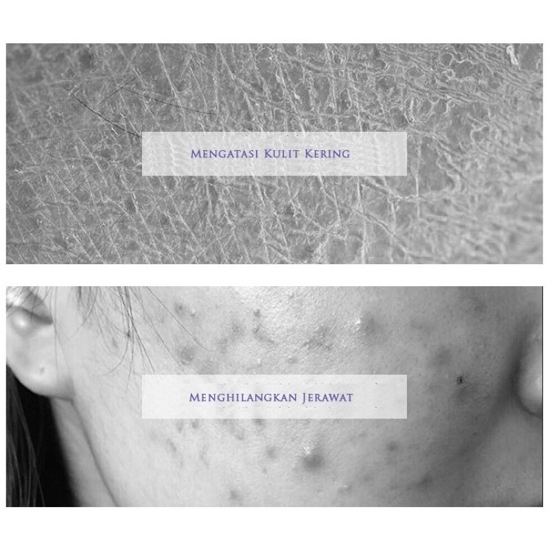 YZKMSKIN Sabun Cair Cuci Muka Pria Atau Wanita Ampuh Mengatasi Kulit Kering Kusam Maupun Wajah Berjerawat Sampai Meronah Glowing