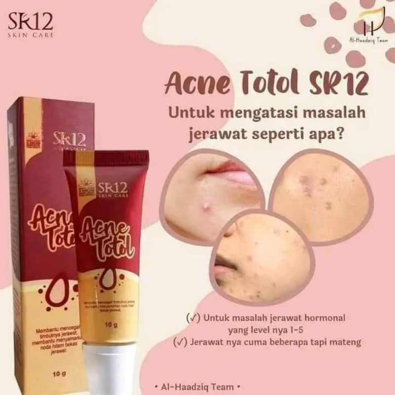 

Acne totol SR12/obat jerawat