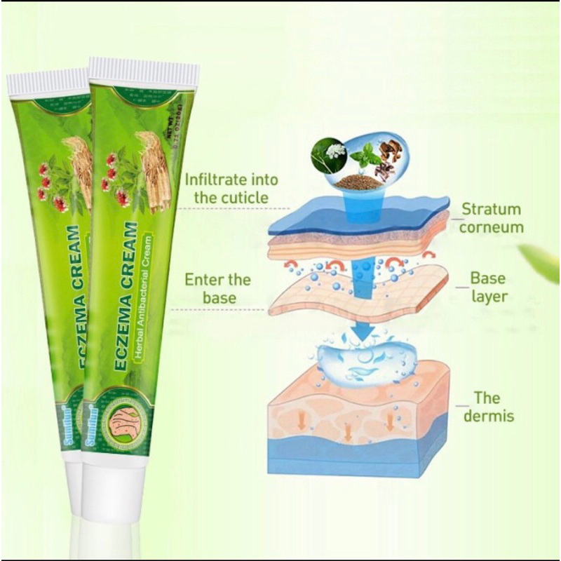 Eczema cream salep anti gatal salep kulit Eksim Dermatitis