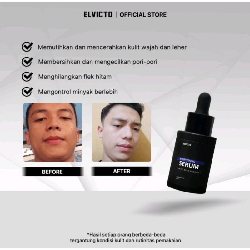 PROMO ELVICTO BRIGHTENING SERUM