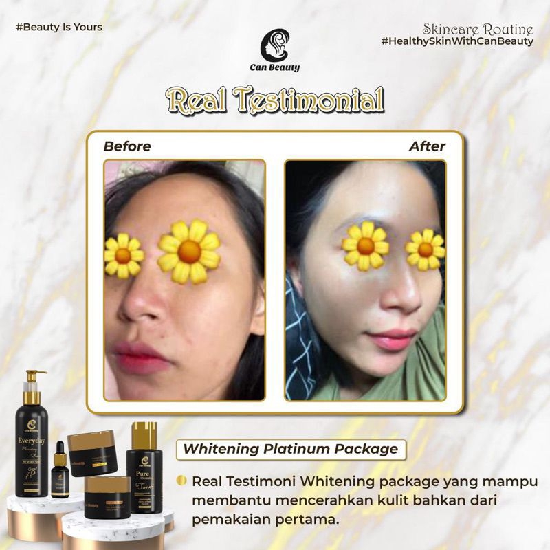 (FREE GIFT PARFUM DSULTHAN) CAN BEAUTY WHITENING PLATINUM PACKAGE