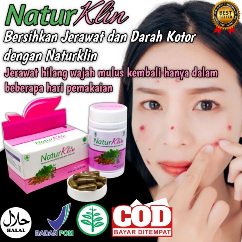 Obat Jerawat Dan Bekas Jerawat BPOM HALAL MUI Naturklin isi 50 kapsul herbal obat jerawat Ampuh meng