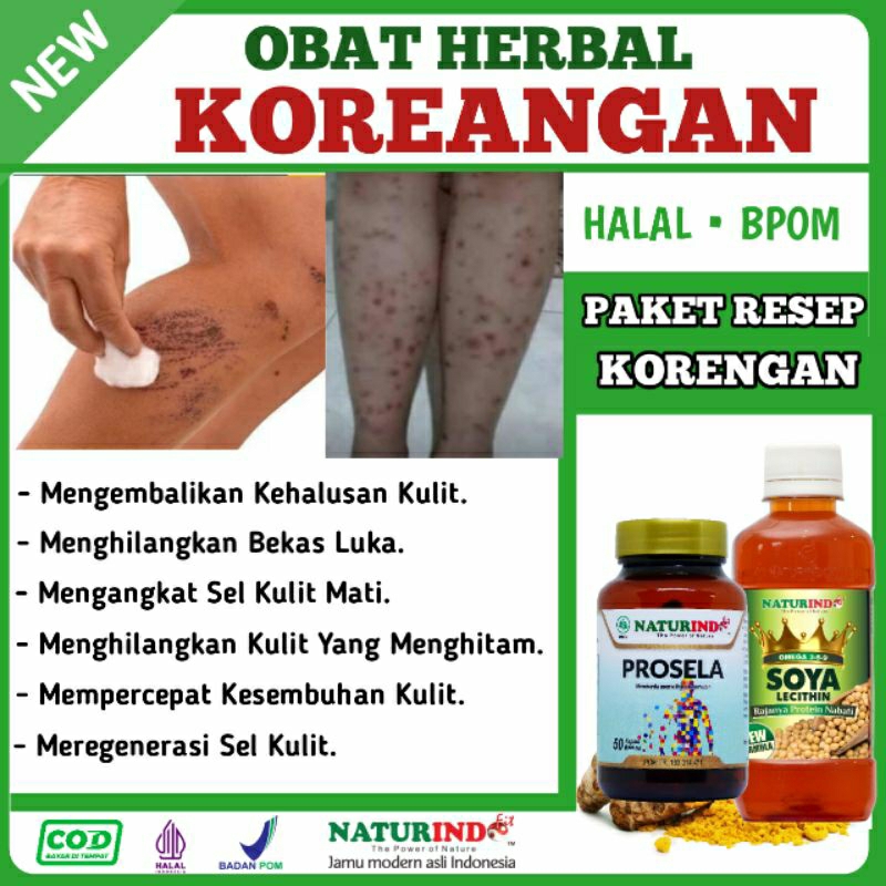 Obat Penghilang Bekas Koreng Luka Hitam Koreng Obat Borok Obat bekas luka Hitam Pada kaki Kulit Gata