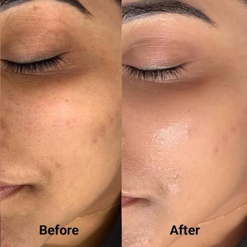 BB Glow Treatment / Sulam Bedak