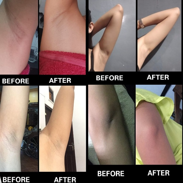 Underarm Brightening  -  Armpit Pemutih Ketiak, Penghilang Bekas Luka BPOM Luciola Cream Pemutih Ketiak &amp; Pemutih Selangkangan PIWPIW Bio Herbal