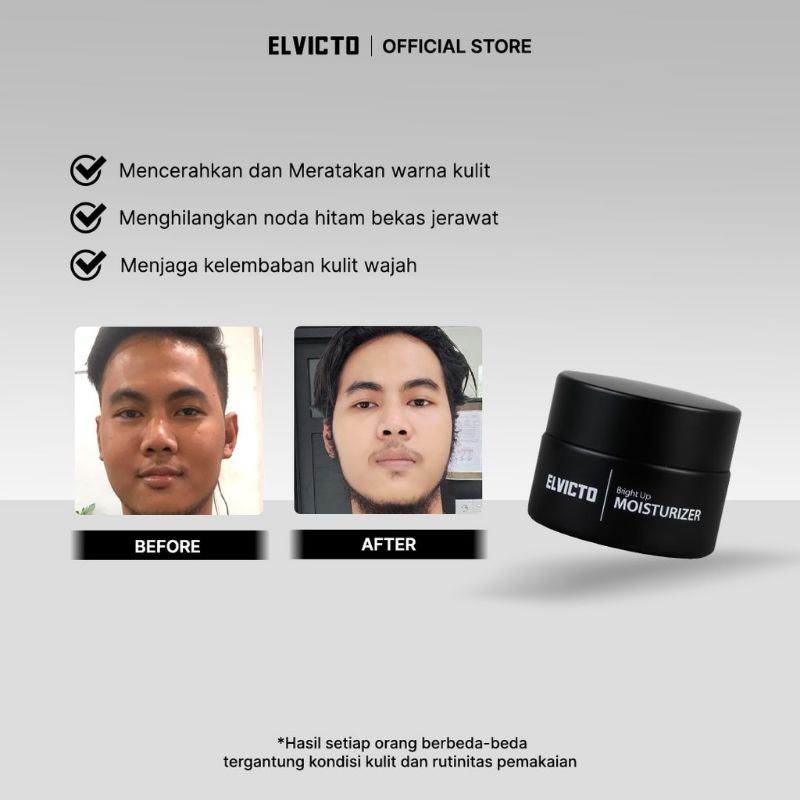 Elvicto Bright Up Moisturizer 15 gr