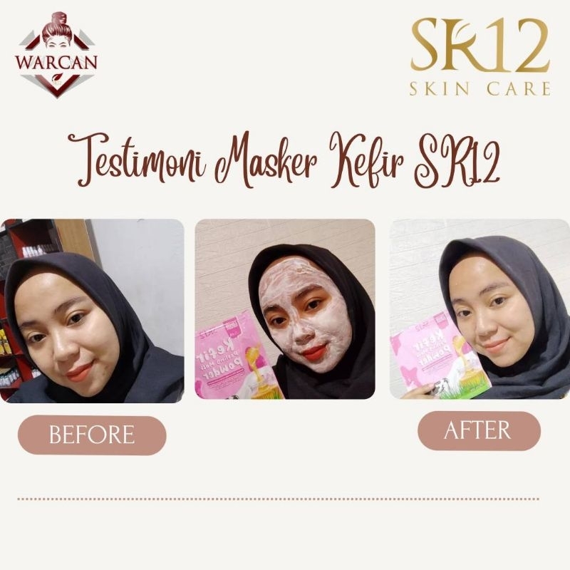 Kefir Peeling Mask Powder Untuk Semua Jenis Kulit