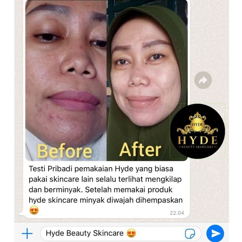 HYDE Beauty Skincare Original