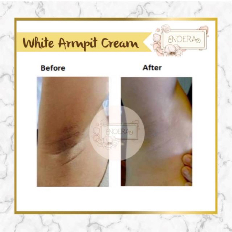 Noera Skin Lightening Cream armpit pemutih ketiak lipatan siku brightening moisturizer 15ml 30ml ml 15 30 NOERA lighteningcream