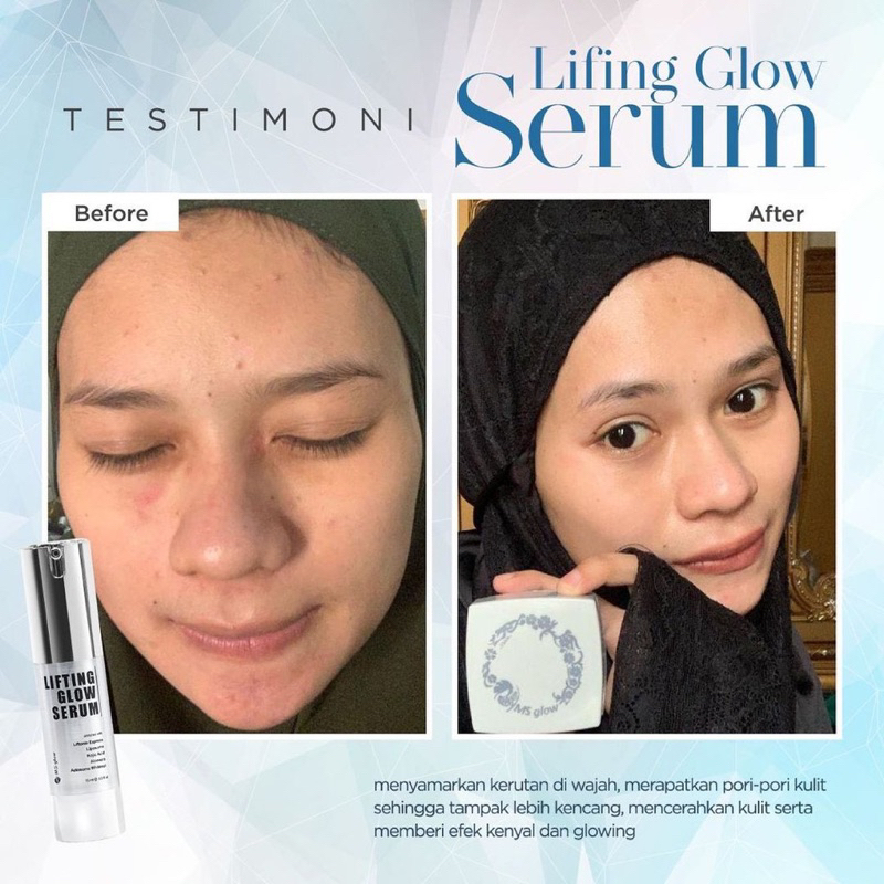 MS GLOW PAKET WAJAH &amp; SERUM MS GLOW