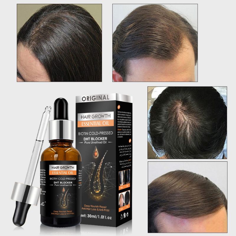 SEEMSURE GROWTH SERUM penumbuh rambut botak anti rontok aminexil spa