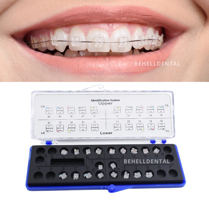 BRACKET BEHEL CERAMIC CLEAR TRANSPARAN ORTHODONTIC ORTHOMERICA - BRACES Permanen American Roth Hook On 345 - Kawat Perbaikan Gigi