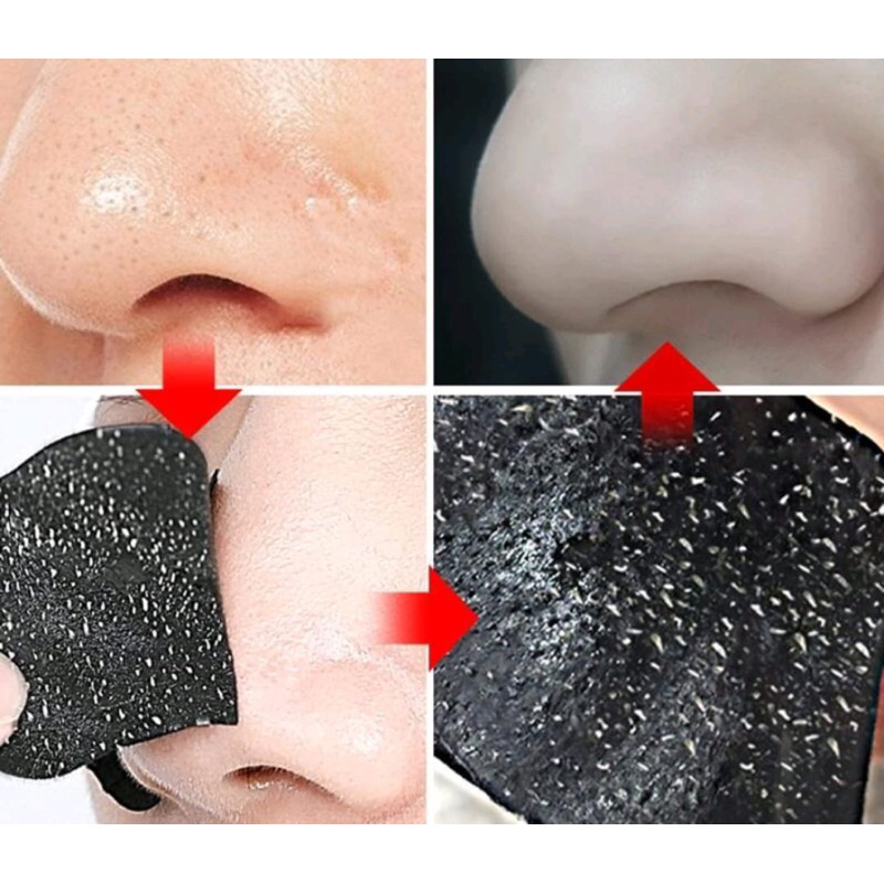 OliveShop ❤️ Komedo Pore Strip Blackhead Remover Pore Pack Strip Pembersih Komedo