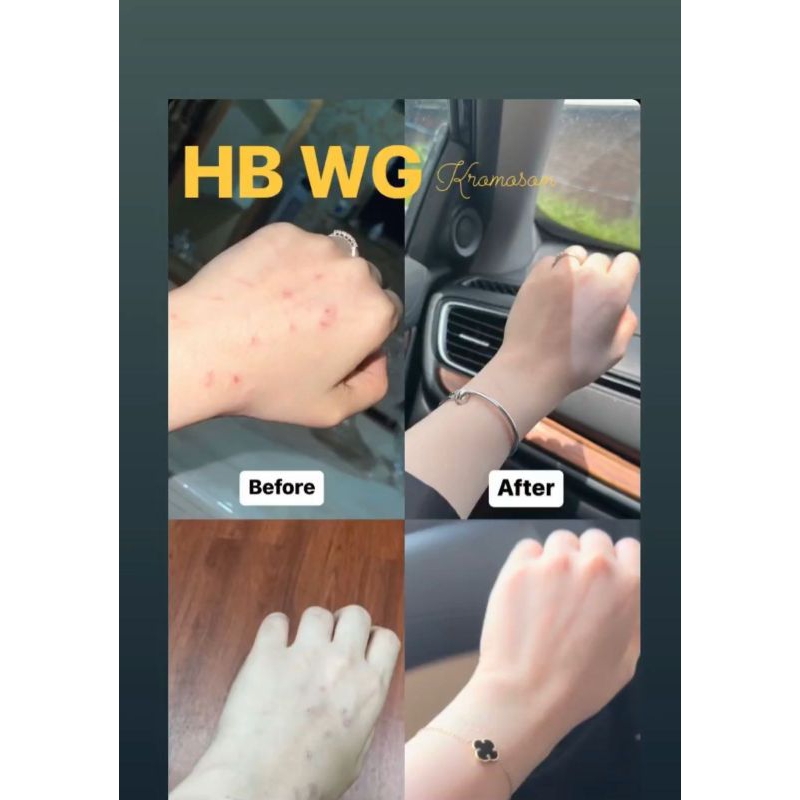 HB Wawan Gold Glow Kromosom 100% ORI