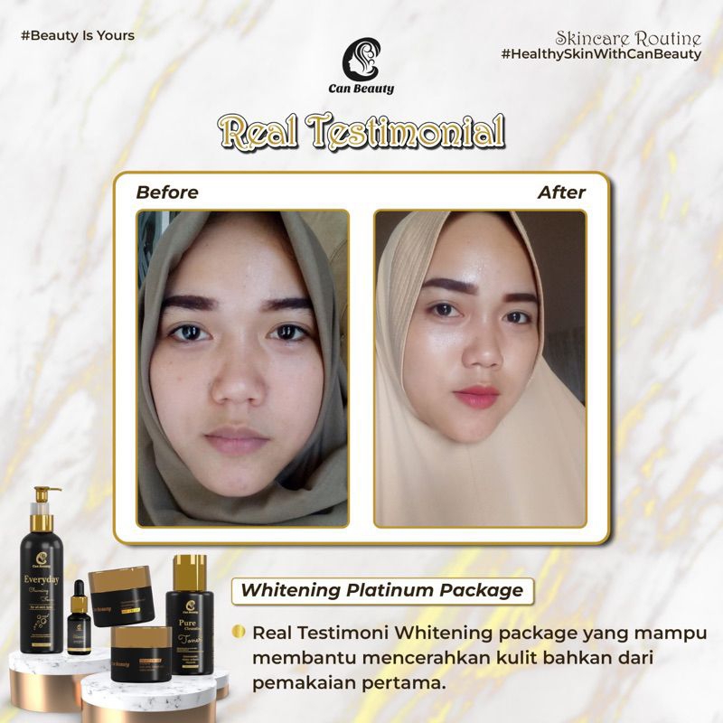 (FREE GIFT PARFUM DSULTHAN) CAN BEAUTY WHITENING PLATINUM PACKAGE