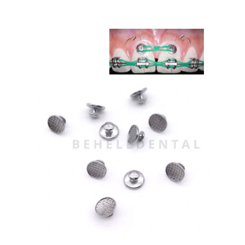 ORIGINAL LINGUAL BUTTON ISI 10 Round Bulat Bundar Bondable - Dental Lingual Buttons Behel Ortho Orthodontic Palatal Bracket Behelldental Braces