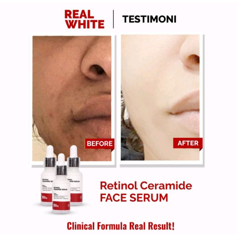 Real White Retinol Ceramide Serum 20ml