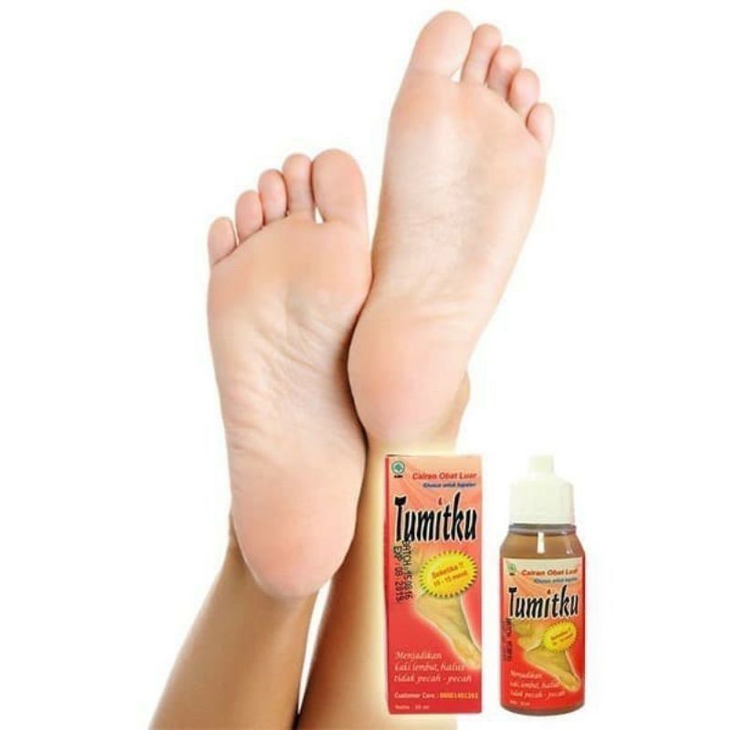 TUMITKU PENGHALUS/ PENGHILANG TUMIT PECAH PECAH