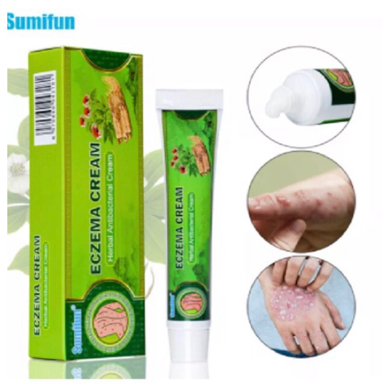 Eczema cream salep anti gatal salep kulit Eksim Dermatitis