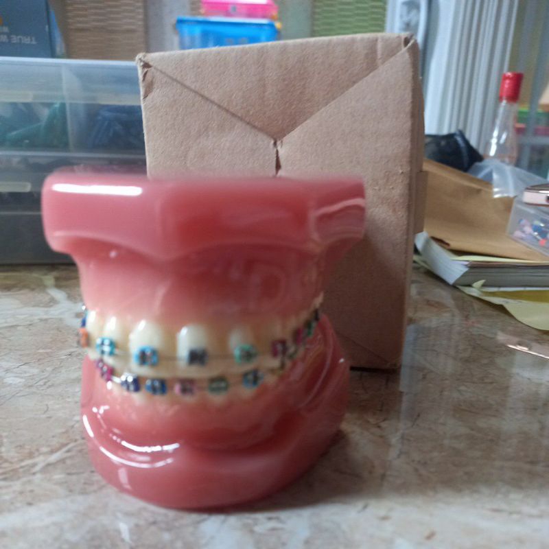 denta model study akrilik / phantom gigi ortodonti / model study ortodonti transparan