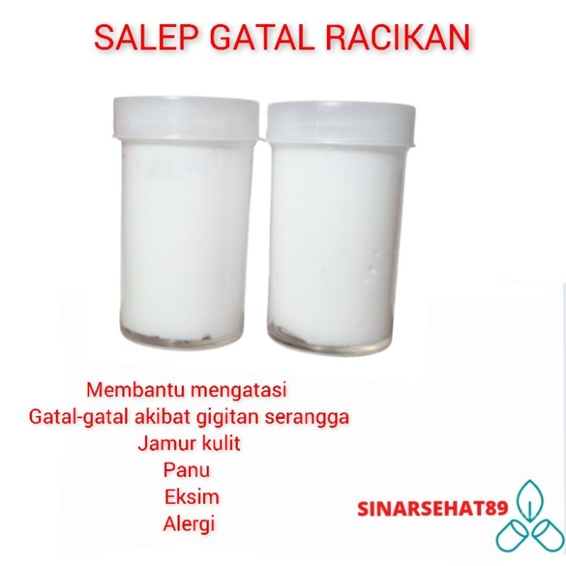 salep gatal racikan salep kutu air, eksim, Jamur, panu