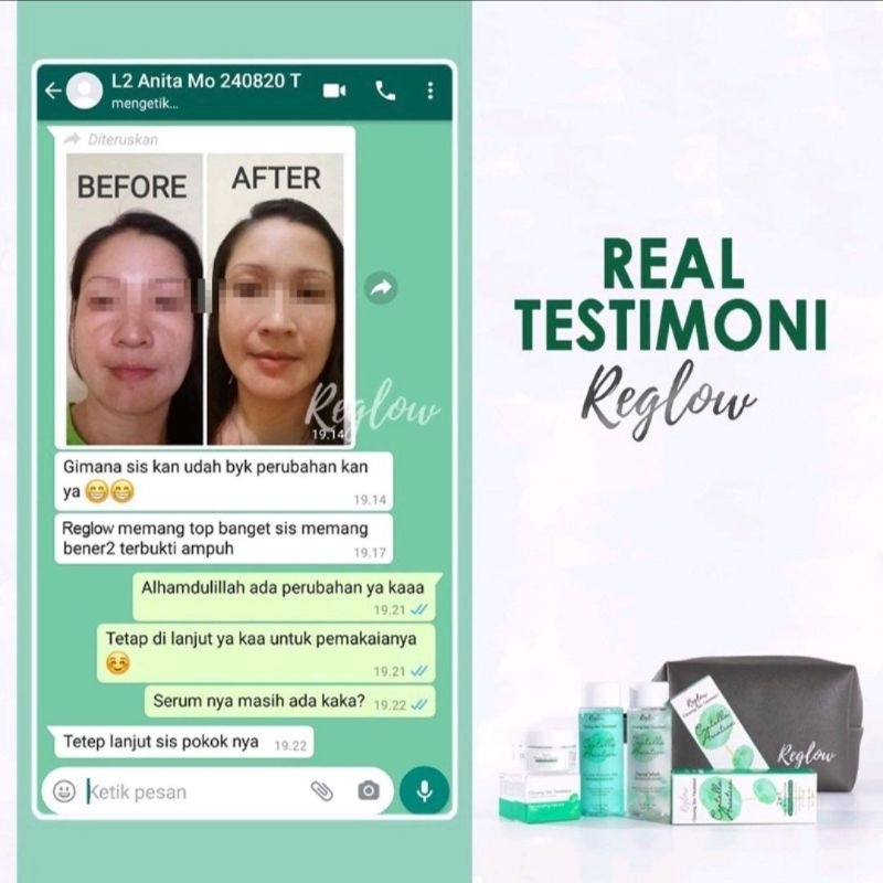 [BISA COD] REGLOW Glow Skin Treatment Skincare Original Glowing Whitening Beauty Series Perawatan Kecantikan Wajah Paket Re Glow Skincare Pemutih Wajah Penghilang Flek Hitam Facial Wash Toner Cream Reg Glow Rglow Doker dr Shindy Putri Official Store resmi