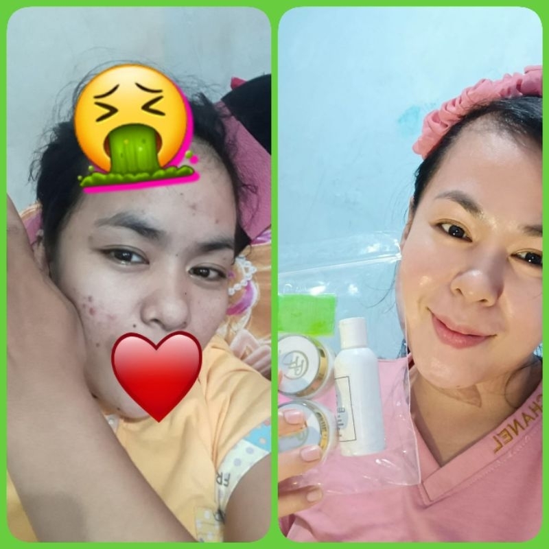 Cream FF paket glowing kemasan baru By Fenny Frans ORI