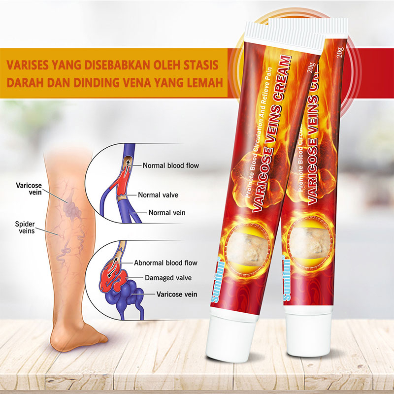 Obat Varises Otat Kaki Bengkak Obat Varises Salep Varises Cream Varises cream Obat Varises Salep Var