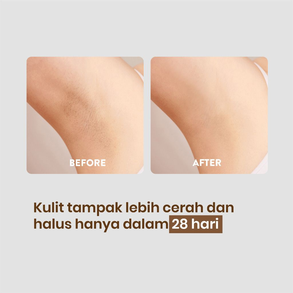 BPOM NPURE Axillary Treatment Licorice/Underarm Serum/Pencerah Ketiak Selangkangan/Brightening Glowing /Moonlight