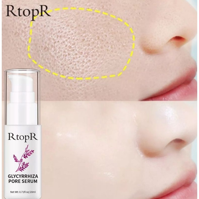 RTOPR GLYCYRRHIZA FACE PORE COLLAGEN