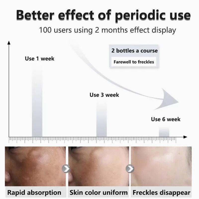 Cream pemutih wajah Krim bintik pemutih 30G Singkirkan melasma, bintik-bintik, bintik matahari, bintik-bintik penuaan, bintik-bintik kehamilan, bintik-bintik gelap Memperbaiki dasar kulit, memutihkan, melembabkan, mencerahkan kulit