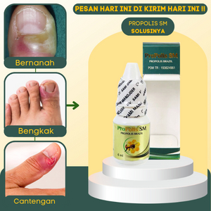 Obat Cantengan, Salep Cantengan, Obat Kuku Bengkak Bernanah, Salep Kuku Bengkak Sakit, Obat Jari Tan