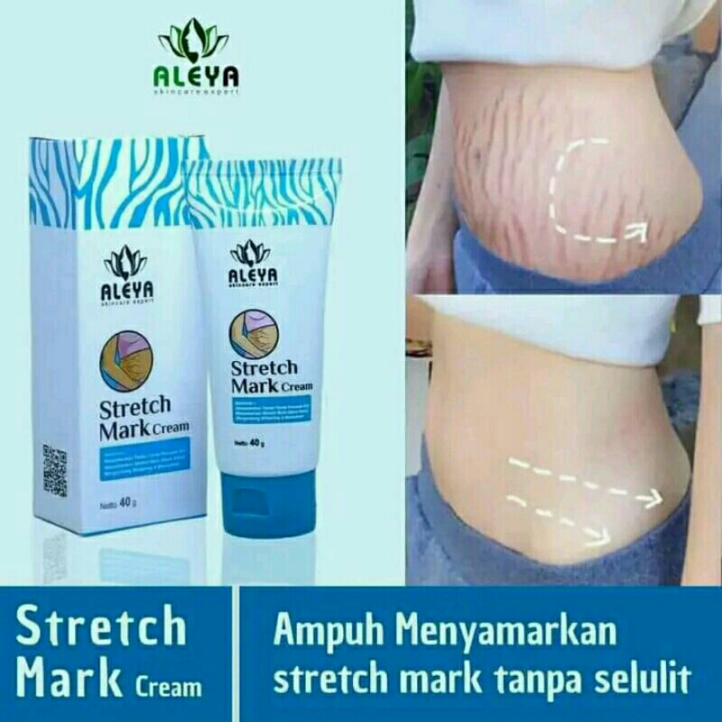 Stretchmark cream aleya stretch mark cream herbal alami BPOM