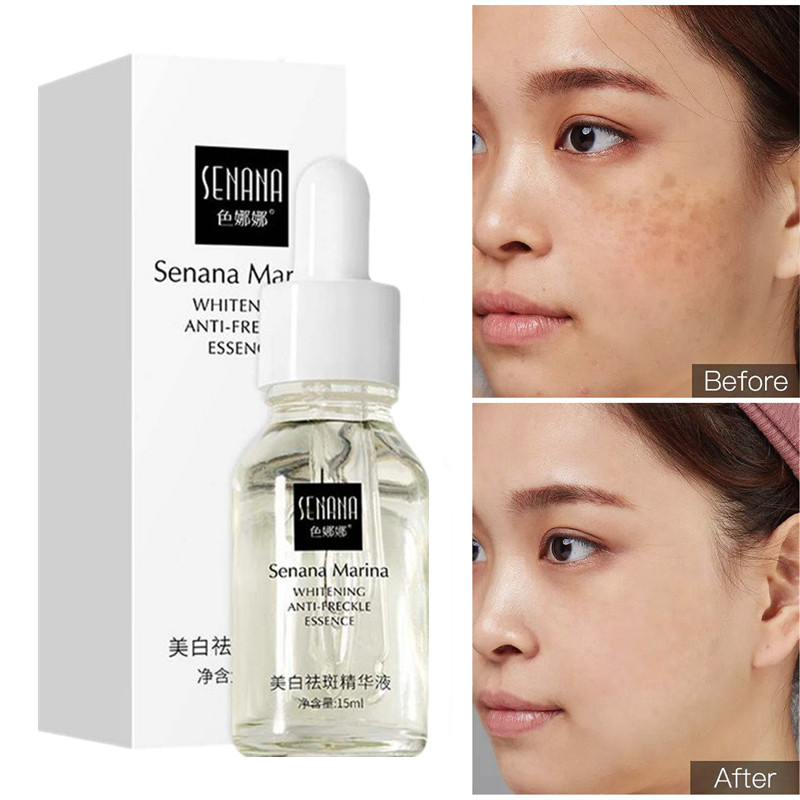 SADOER 30ml Niacinamide Whitening Spot Removal  Freckle Serum Dull Black Melanin Melasma Remover