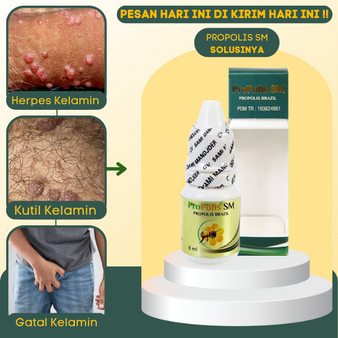 Obat HPV Kutil Kelamin, Salep Kutil Kelamin HPV, Obat Kutil Anus Pria Wanita, Obat Perontok Kutil Ke