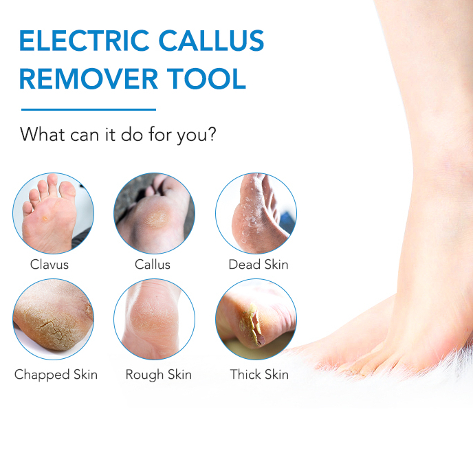 Penghalus Tumit Kaki Kapalan Elektrik Callus Electric Remover Pedicure Menicure