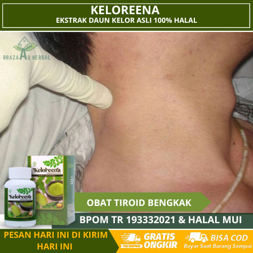 Obat Tiroid Leher Bengkak, Benjolan Di Leher, Gondok, Hipertiroid, Obat Gondok Dileher, Obat Pengaha