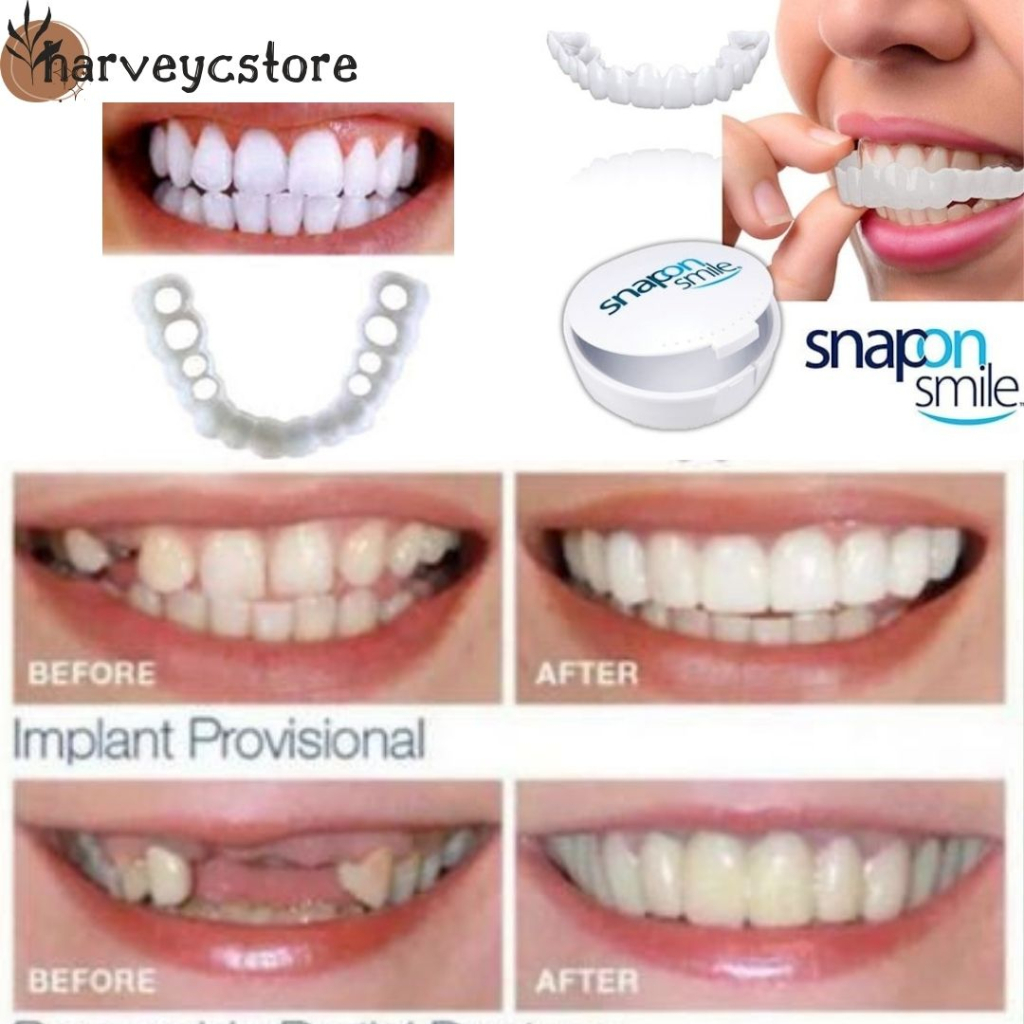 (cod) Snap on Smile Gigi Palsu 1 Set Atas Bawah Venner Pemutih Gigi Instan ORIGINAL 100%