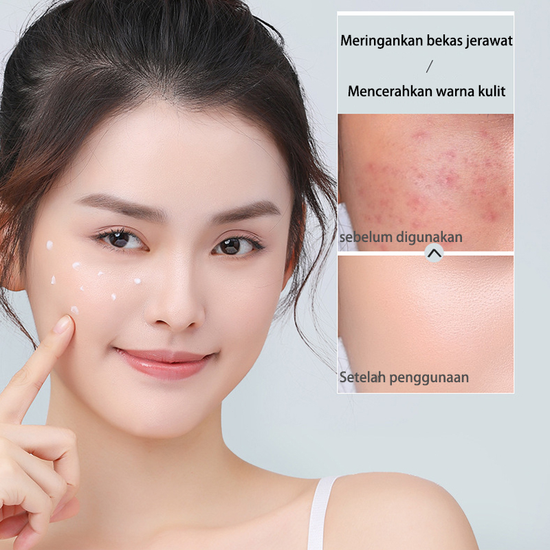 penghilang bintik hitam krim penghilang flek hitam cream penghilang flek hitam 4ml*20 Penghilang Melasma Krim Penghilang Bintik Pemutih Anti Penuaan Krim Penghilang Bintik Gelap