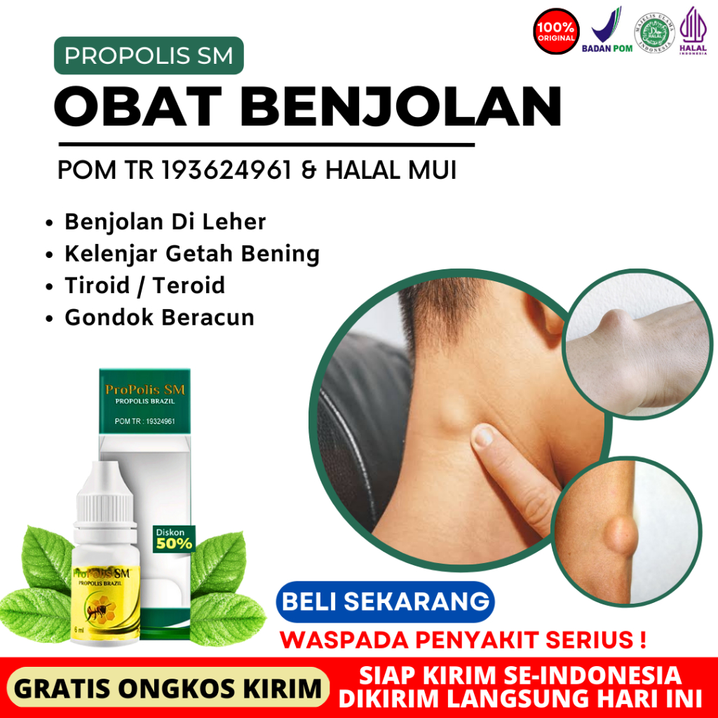 Obat Lipoma Di Oles dan Minum, Penghilang Benjolan Lipoma - Benjolan Lemak - Tumor Lemak - Propolis 