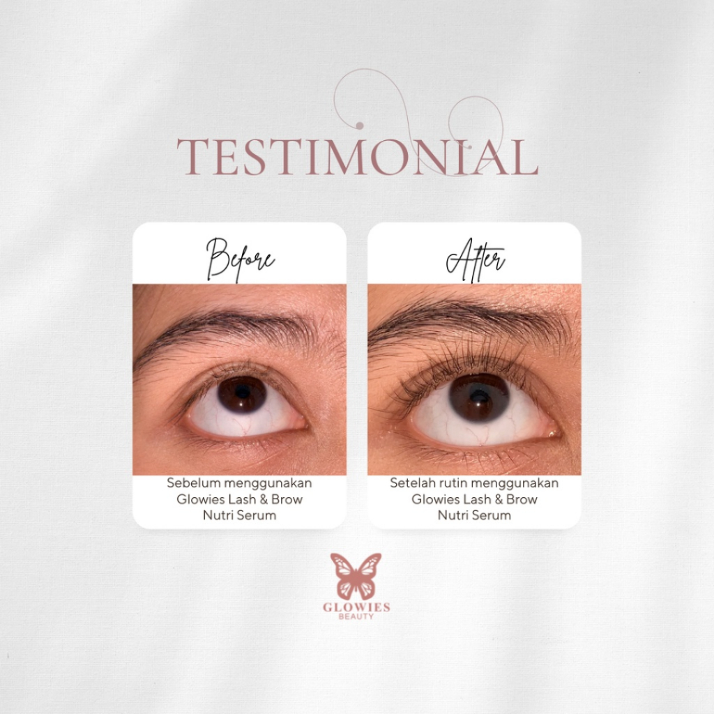 [ Agen Resmi ] Glowies Beauty Eyelash &amp; Brow Nutri Serum - Serum Alis dan Bulu Mata