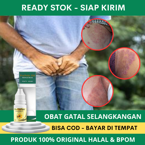 Obat Gatal Selangkangan, Obat Selangkangan Hitam dan Gatal, Obat Gatal Selangkangan Pria Wanita, Oba