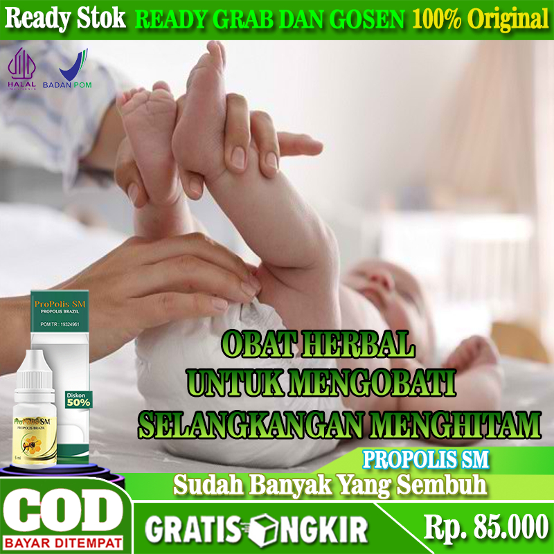 Obat Untuk Selangkangan Bayi Menghitam, Penghilang Bercak Hitam Pada Area Pangkal Paha Bayi, Propoli