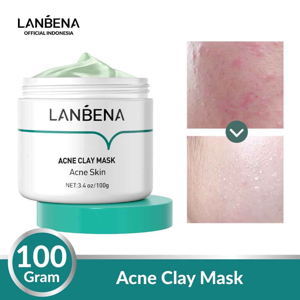 ✨ AKU MURAH ✨ LANBENA Acne Clay Mask Cream 100 GR