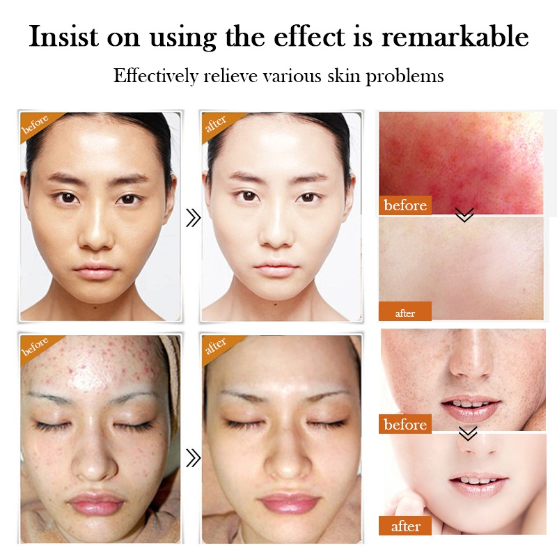 SK FI DIOR-SK Whitening Freckle Cream Remove Dark Spots Anti Freckle Cream Niacinamide Fade Pigmentation Melasma Brighten Creams concealer focallure【 Free Delivery+ COD + dikirim dalam 24 jam】