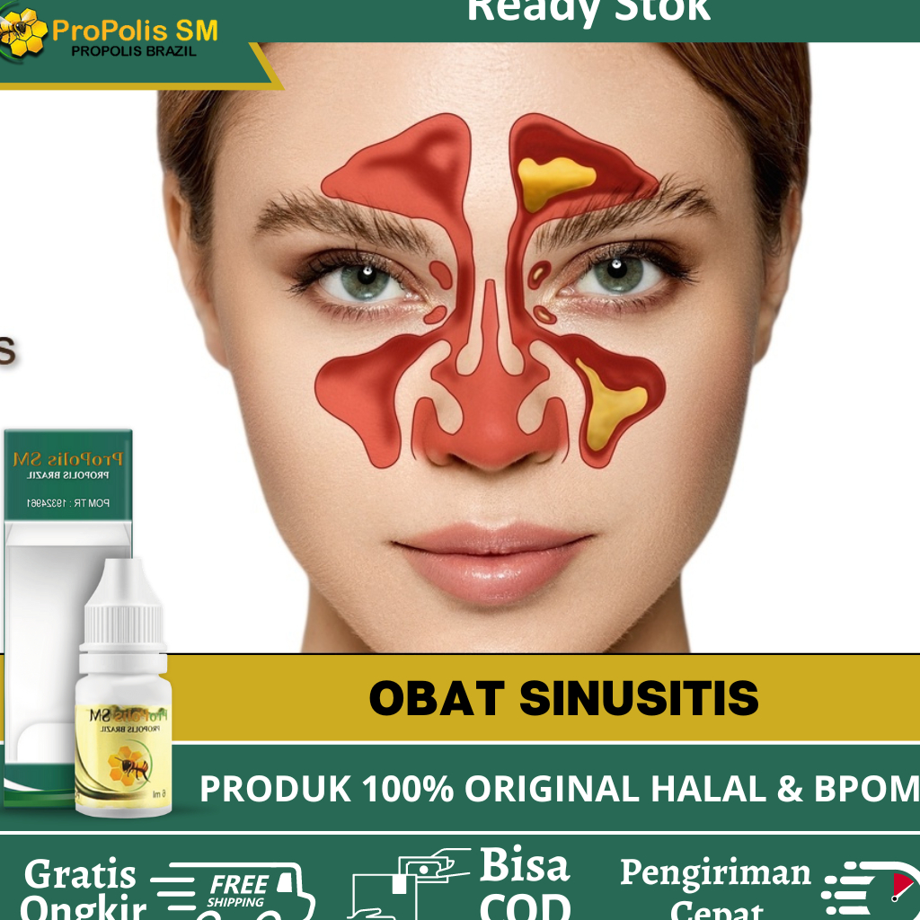 Obat Sinusitis, Obat Sinus, Obat Sinusitis Anak Dan Dewasa, Obat Penyakit Sinusitis 100% Alami, Sinu