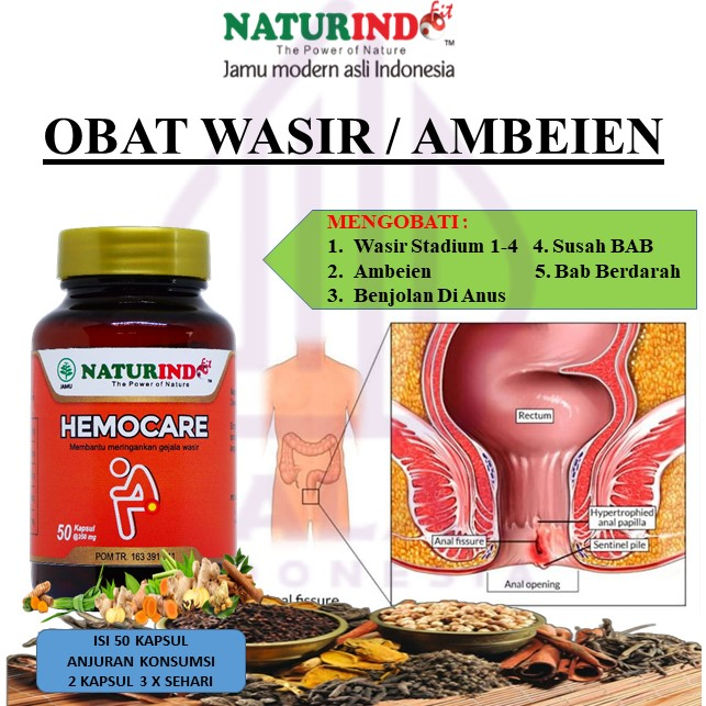 Obat Wasir Stadium 4 benjolan Anus Bab Berdarah