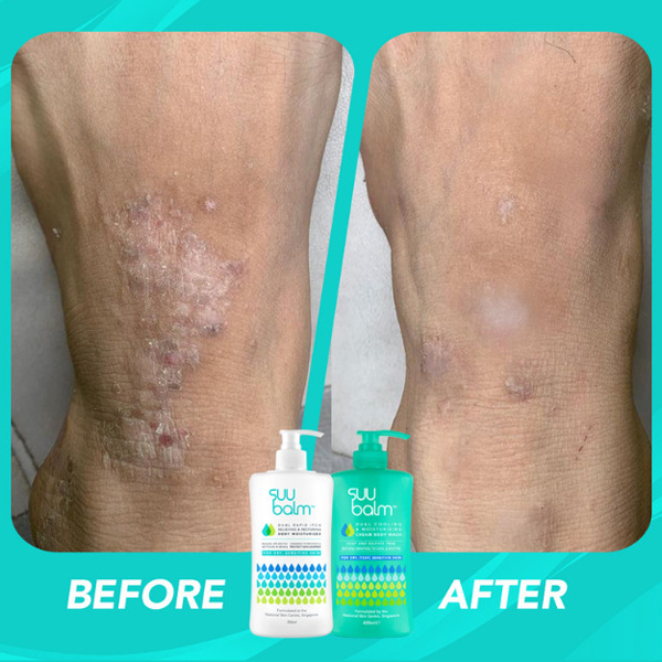 SUU Balm Adult Body Wash Cream Dry Itchy Sensitive Problem Skin 100ml